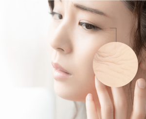 AGING-SKIN_01